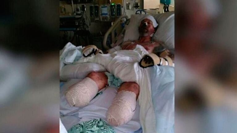 Greg Manteufel estuvo más de un mes internado en un hospital de Wisconsin.