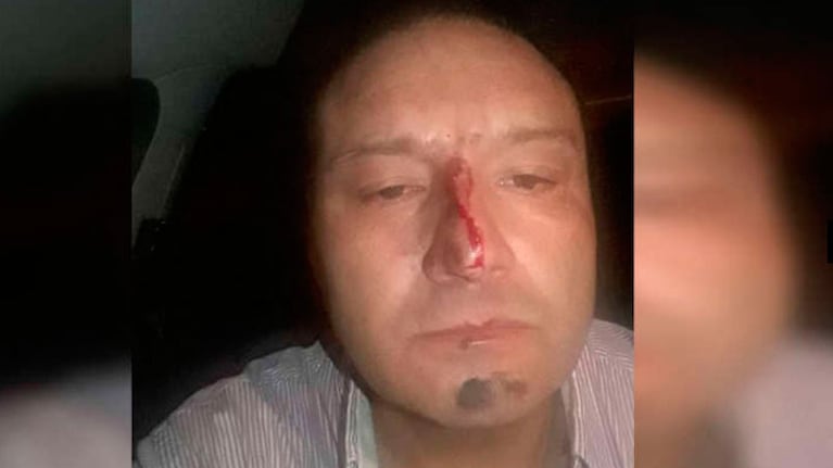 Gustavo Vinderola sufrió un inexplicable ataque al intentar cruzar un piquete. (Foto: Cadena3)