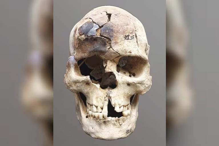 Hallaron una momia de más de 12 millones de años.  (Imagen: Associated Press).