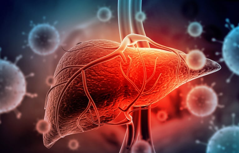 Hepatitis.