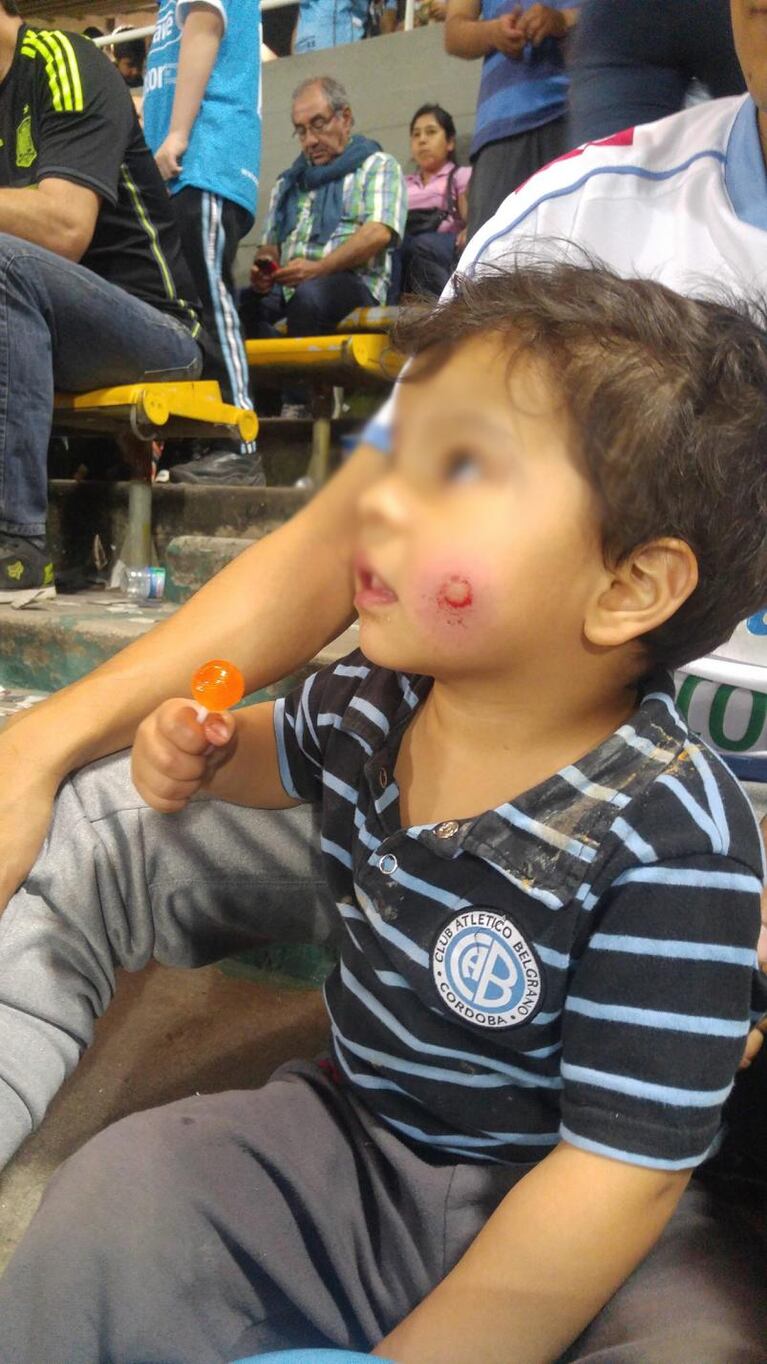 Hirieron a un nene durante el partido de Belgrano ante Coritiba