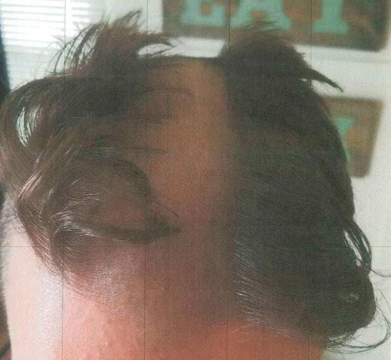 Hizo un corte de pelo desastrozo y doloroso... ¡Y terminó preso!