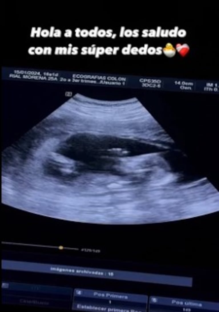 “¡Hola a todos!”: la tierna ecografía que publicó More Rial de su segundo bebé con un cordobés