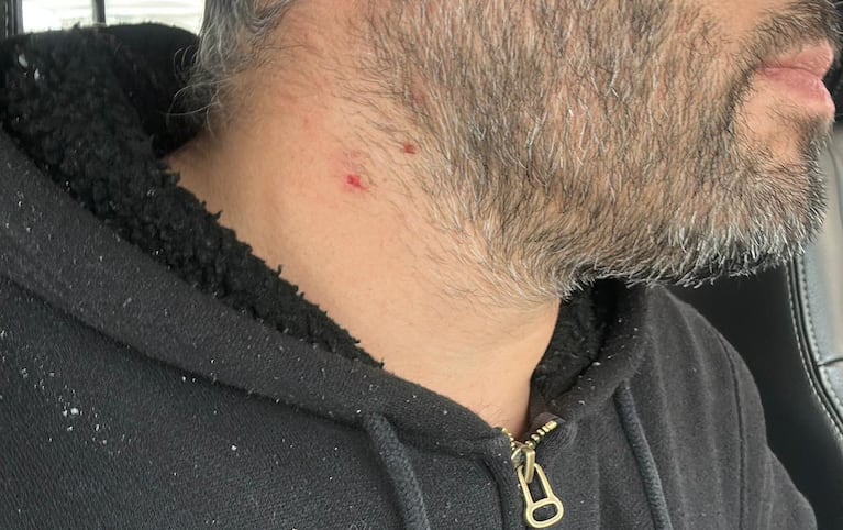 hombre recibió un balinazo desde un asentamiento urbano en plena luz del día.