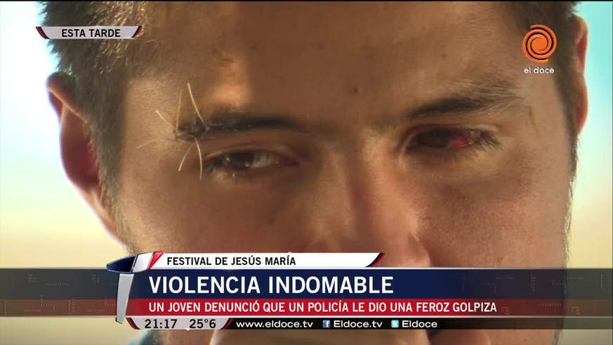 Desgarrador: el relato del joven golpeado por un policía