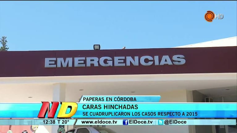 Preocupa el aumento de los casos de paperas en Córdoba