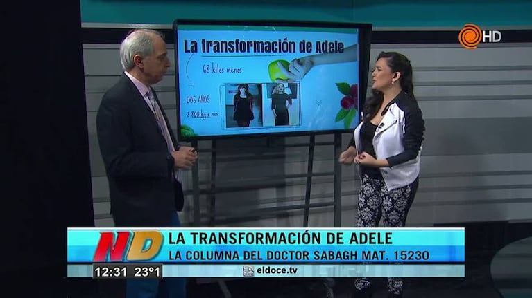 Dr. Sabagh: La transformación de Adele