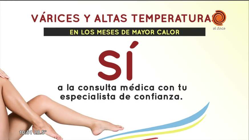 Várices y altas temperaturas