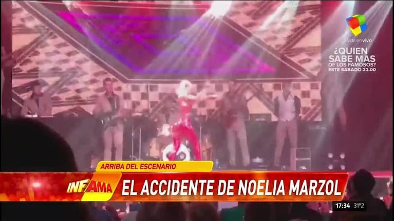 El fuerte golpe en la cara de Noelia Marzol