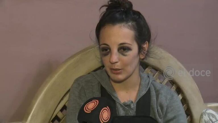 El dramático relato de la joven golpeada por su ex novio