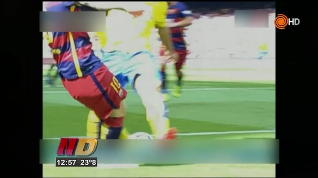 La lesión de Messi