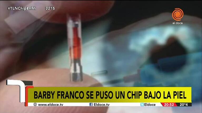 ¿Cómo funciona el chip que se puso Barby Franco en el cuerpo?