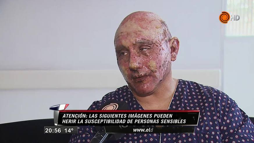 El drama del herido en la explosión de GNC