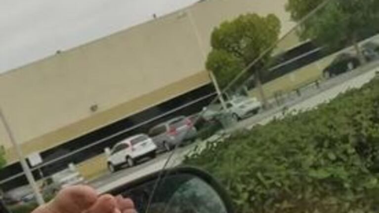 Su pierna cobró vida propia luego del gimnasio