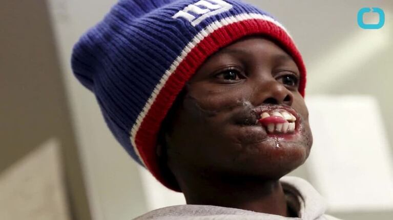 Un niño fue atacado por un chimpancés