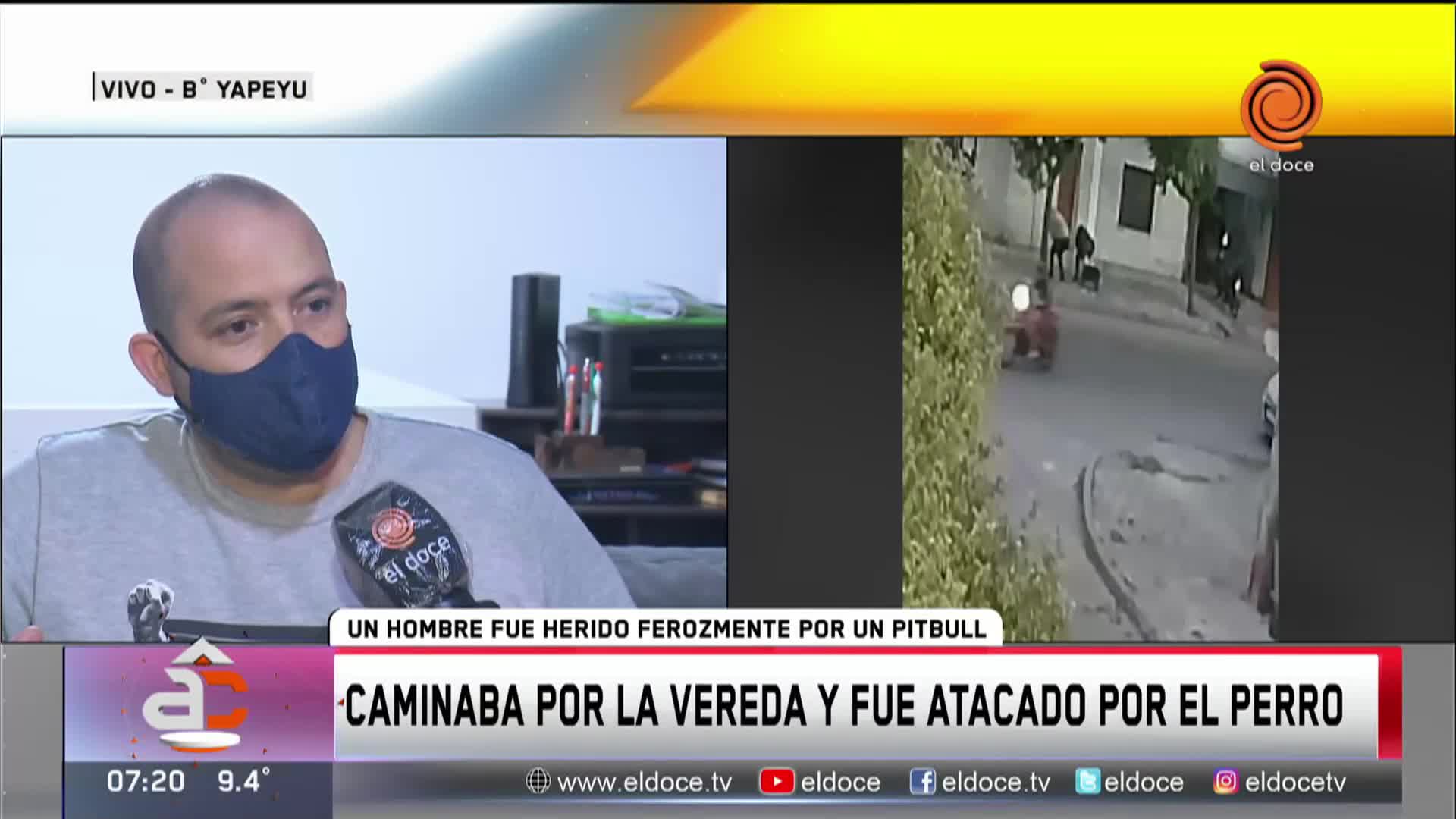 Lo atacó un pitbull y terminó internado en el hospital