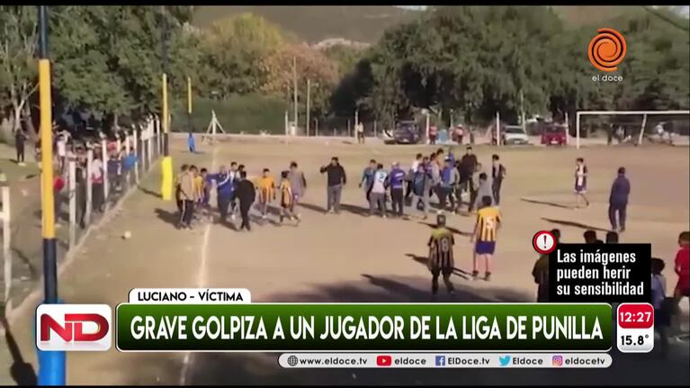 Habló el joven agredido en un partido de fútbol en La Calera
