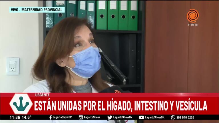 Nacieron siamesas en el Materno Provincial de barrio San Vicente