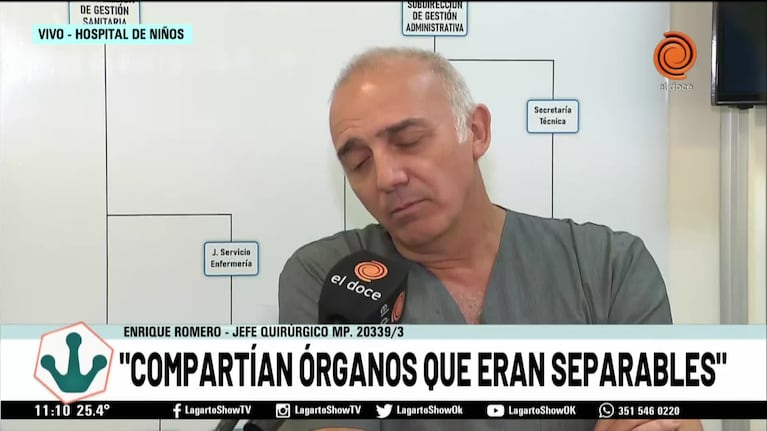 Separaron a las siamesas que compartían hígado e intestino en Córdoba