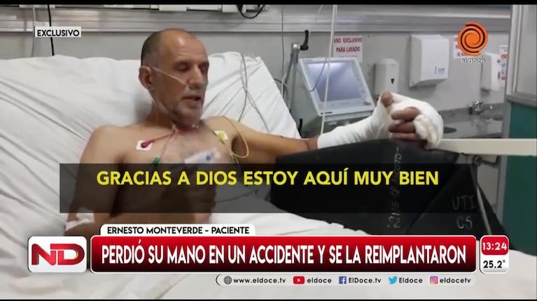 Habló el hombre al que le reimplantaron su mano amputada