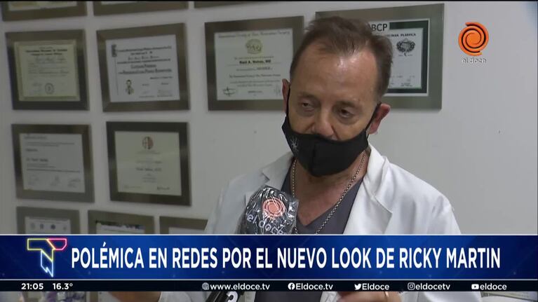 Qué opinan los especialistas sobre la presunta operación de Ricky Martin