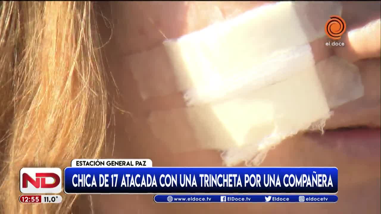 Habló la menor atacada con una trincheta