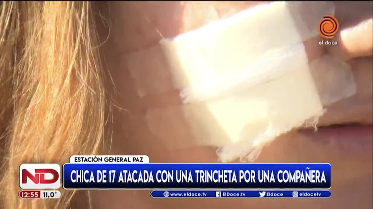 Habló la menor atacada con una trincheta