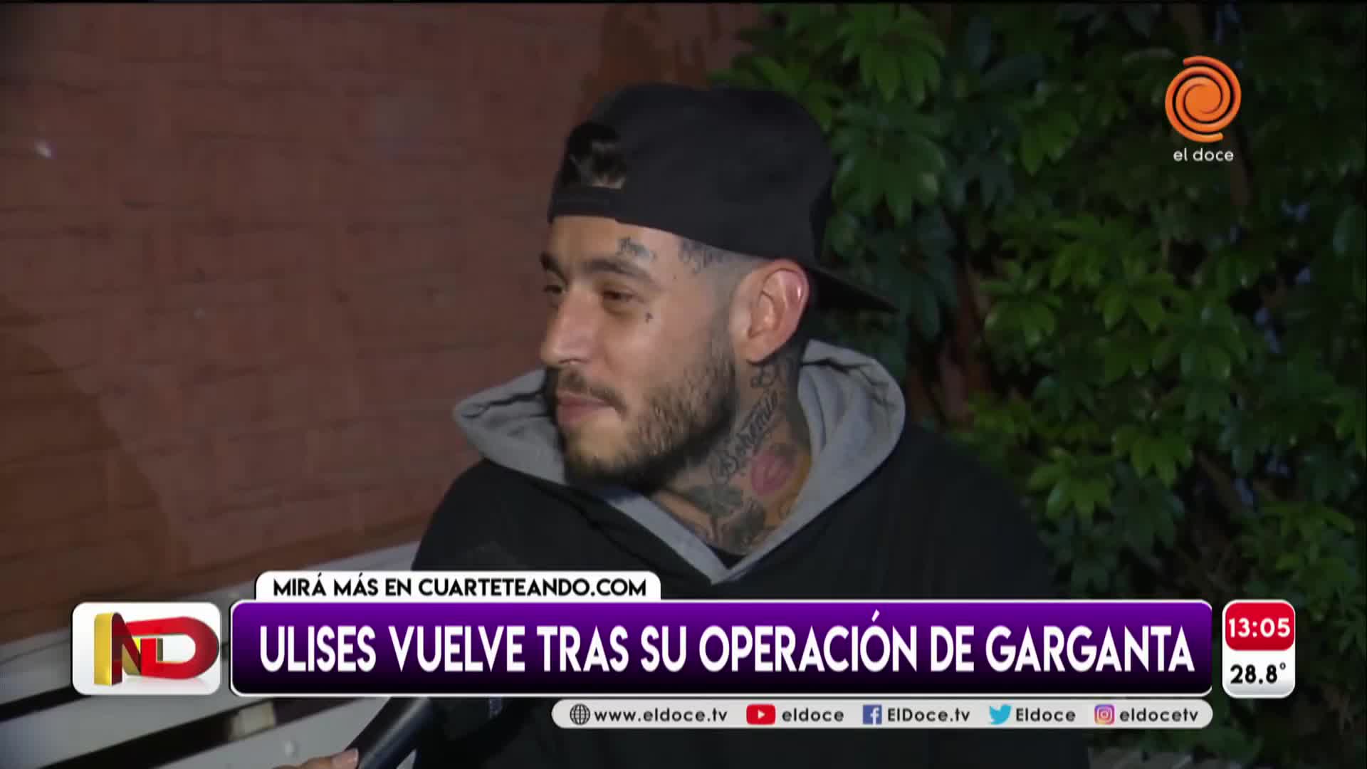 Ulises respondió a quienes dudaron de su operación