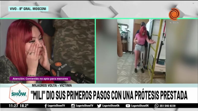 Milagros dio sus primeros pasos con una prótesis 