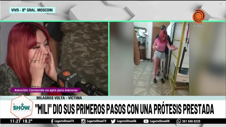 Milagros dio sus primeros pasos con una prótesis