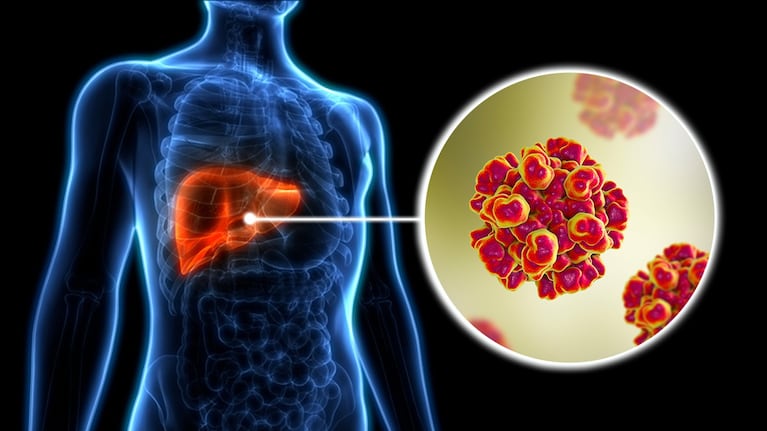 Día Mundial contra la Hepatitis: cómo se transmite y qué tipos existen