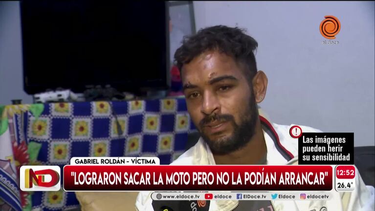Lo atacaron para robarle la moto y casi pierde un ojo
