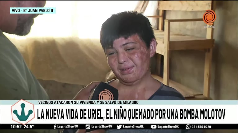 Así vive el nene que quemaron con una bomba molotov