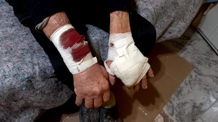 El jubilado asaltado violentamente en Bialet Massé: “Me pegaron con un fierro”