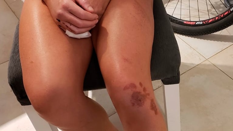 La bronca de la ciclista asaltada: “Perdí la cuenta de las veces que me robaron”