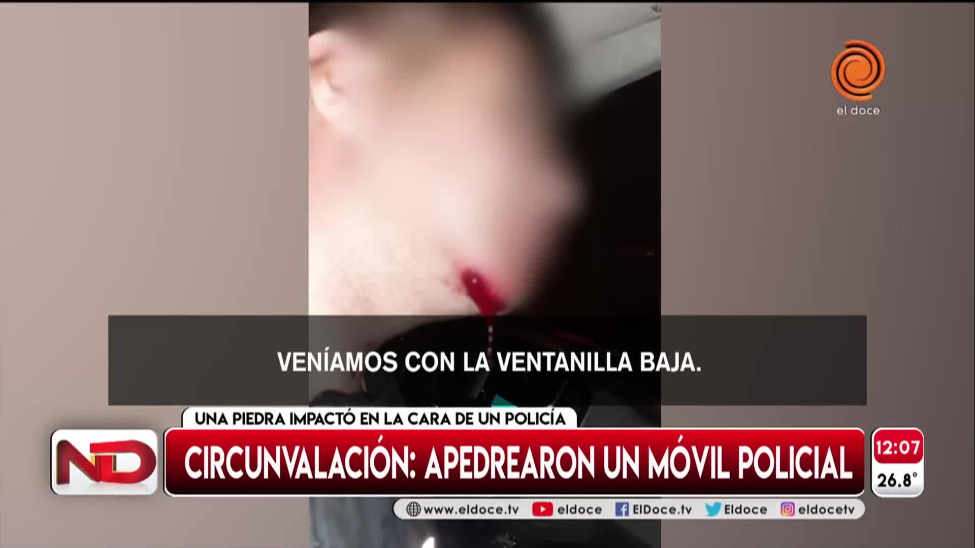 Circunvalación: apedrearon un móvil policial 