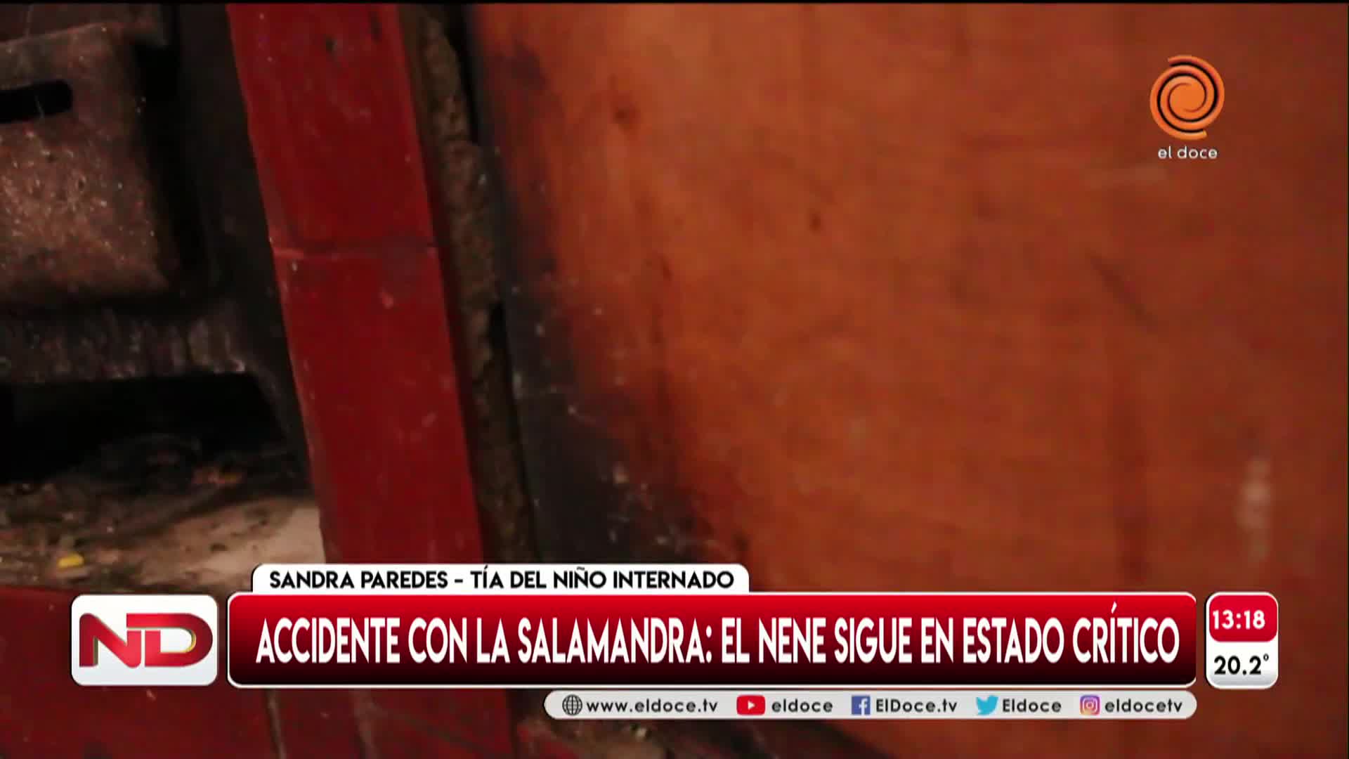 El nene quemado con una salamandra está más complicado