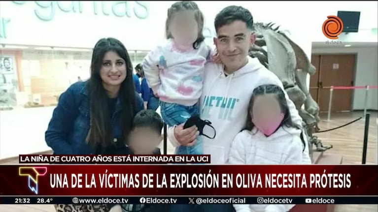 Una niña espera cuatro prótesis tras una explosión en la que murió su hermano