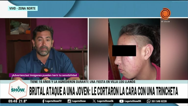 El relato de la joven que denuncia un ataque con trincheta