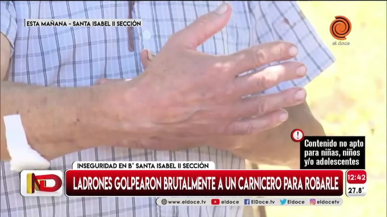 El relato del carnicero asaltado y golpeado en Córdoba