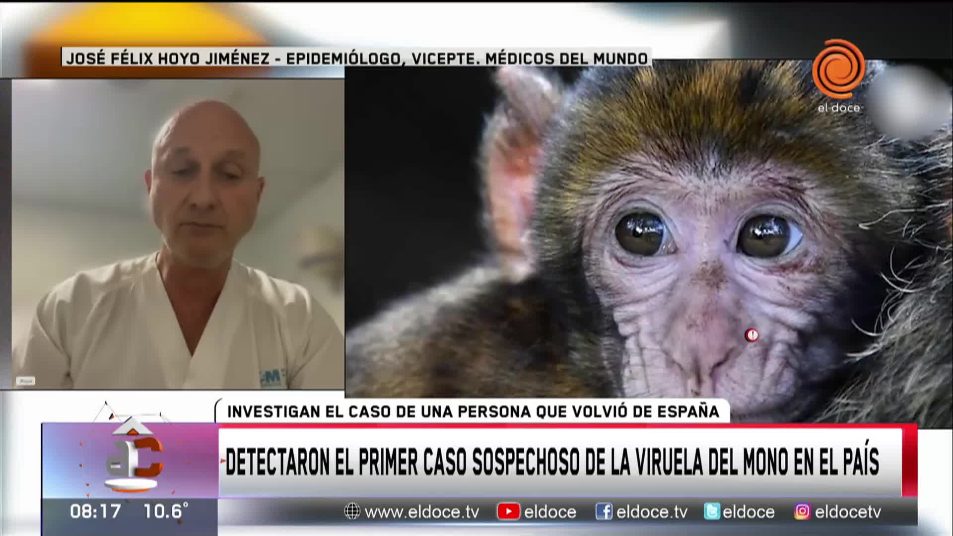 Alertan sobre la transmisión de la viruela del mono
