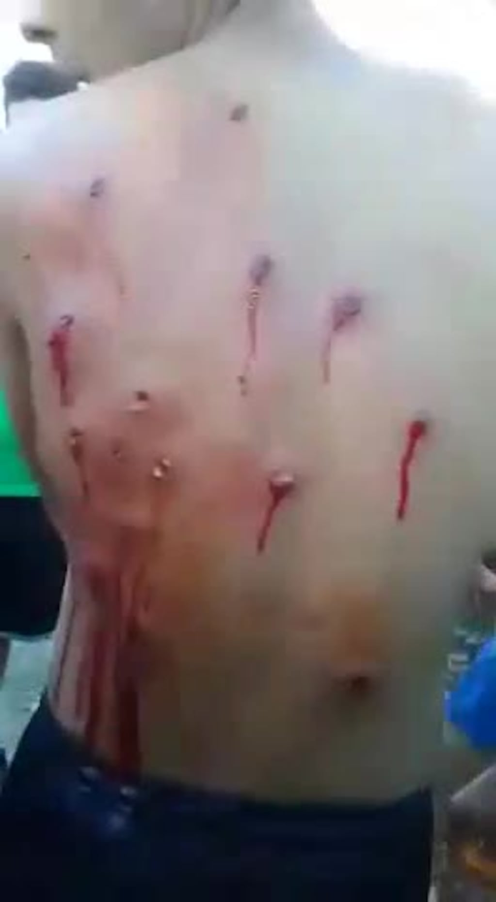 El video de uno de los heridos en Granja de Funes II