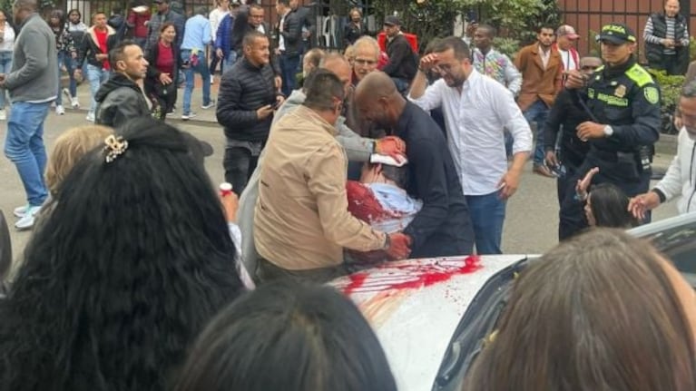 Escalofriante: así le dispararon en la cabeza al senador colombiano Miguel Uribe Turbay