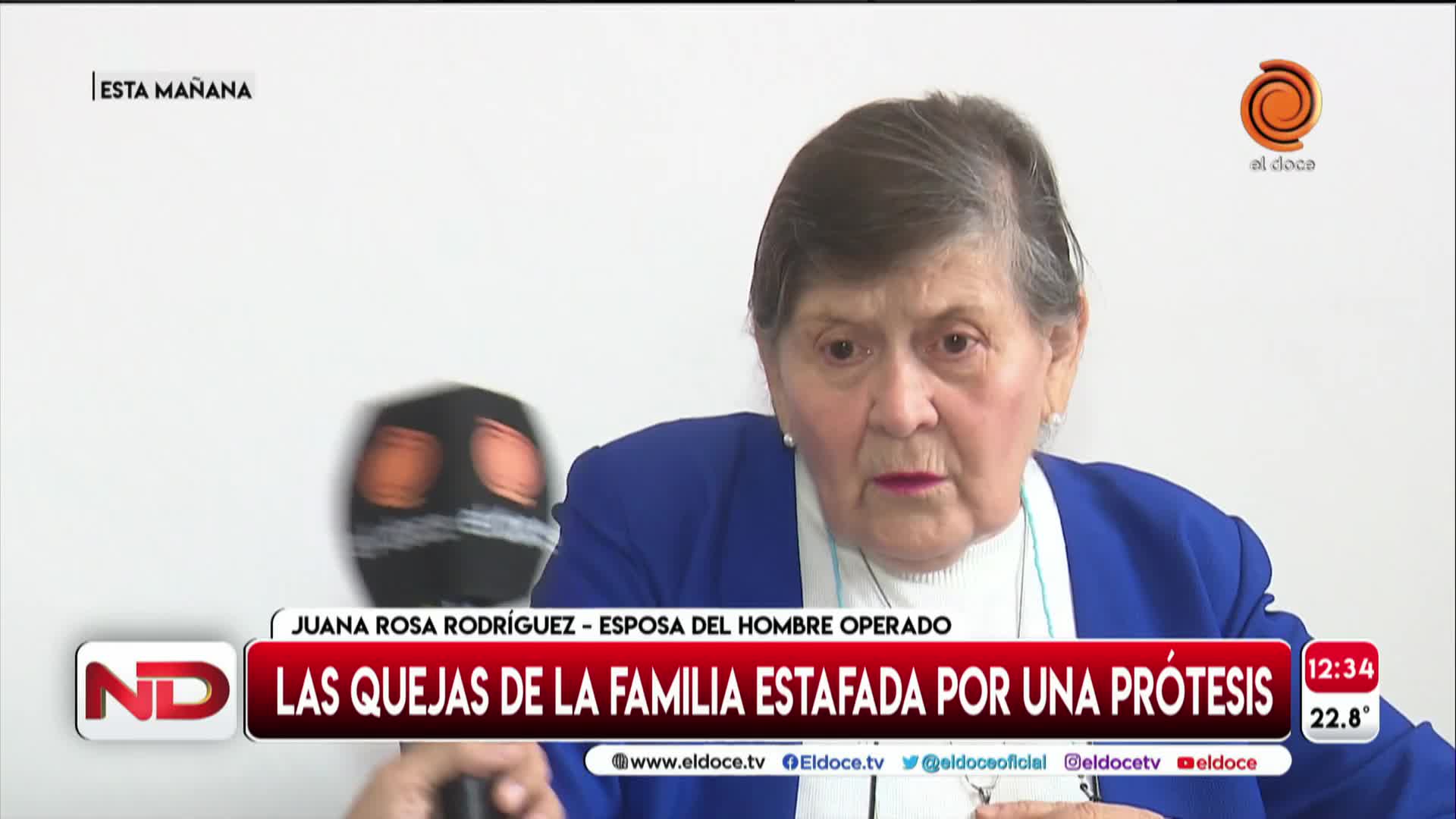 Estafa en el Hospital de Clínicas: el dolor de la esposa del hombre operado