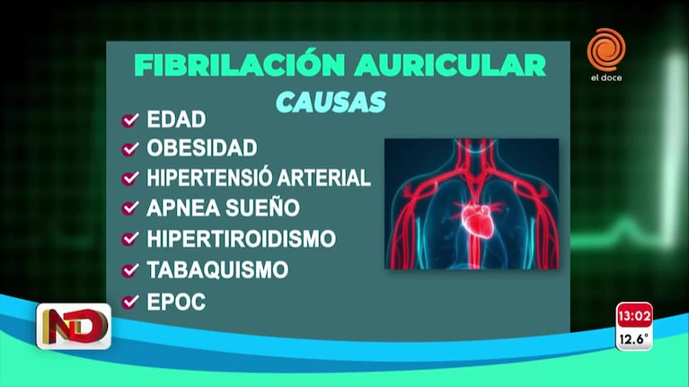 Qué es la fibrilación auricular y cómo evitarla