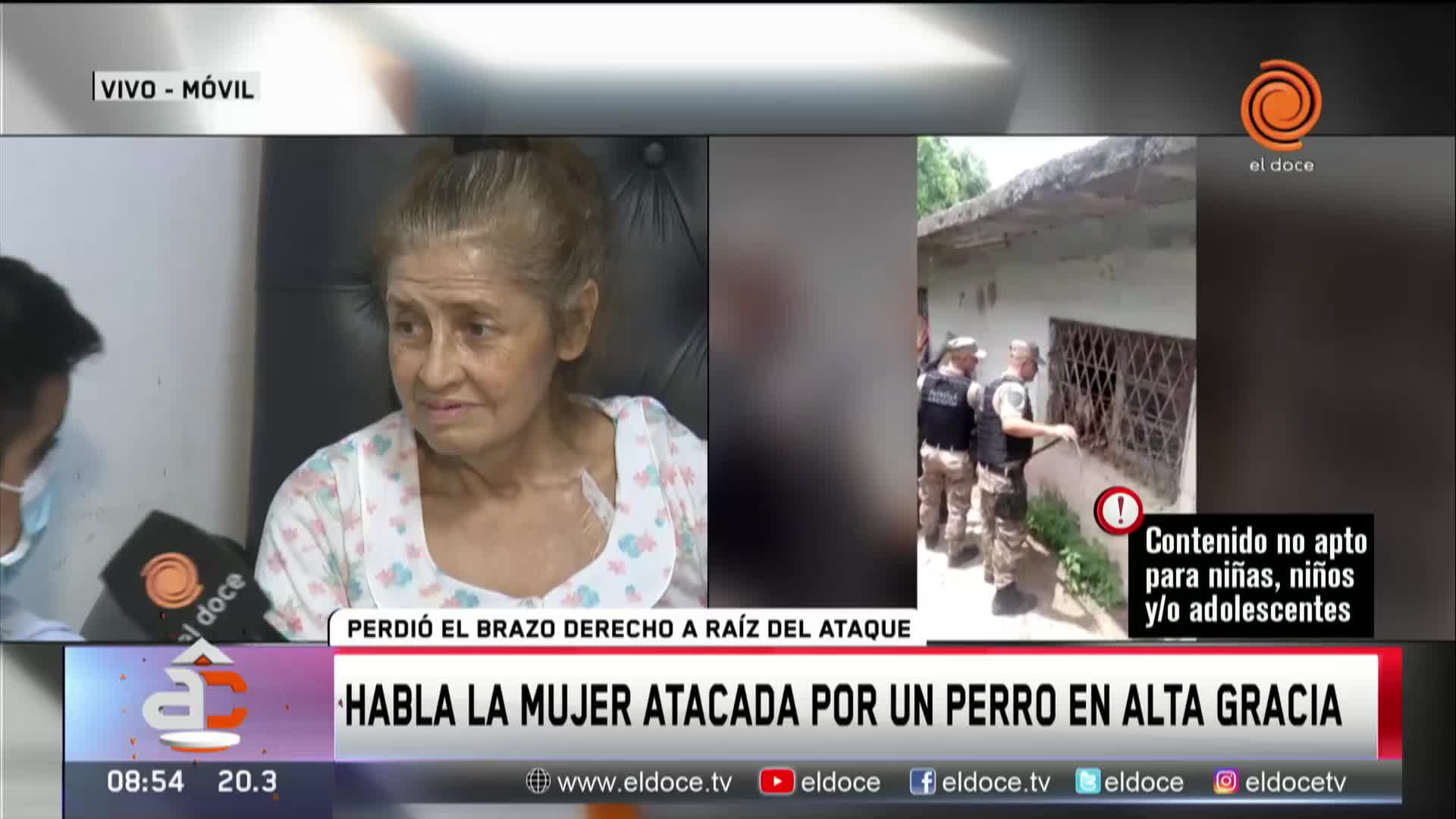 El crudo relato de la mujer atacada por un Pitbull