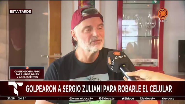 Sergio Zuliani contó que motochoros lo atropellaron para robarle
