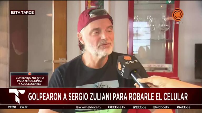 Sergio Zuliani contó que motochoros lo atropellaron para robarle