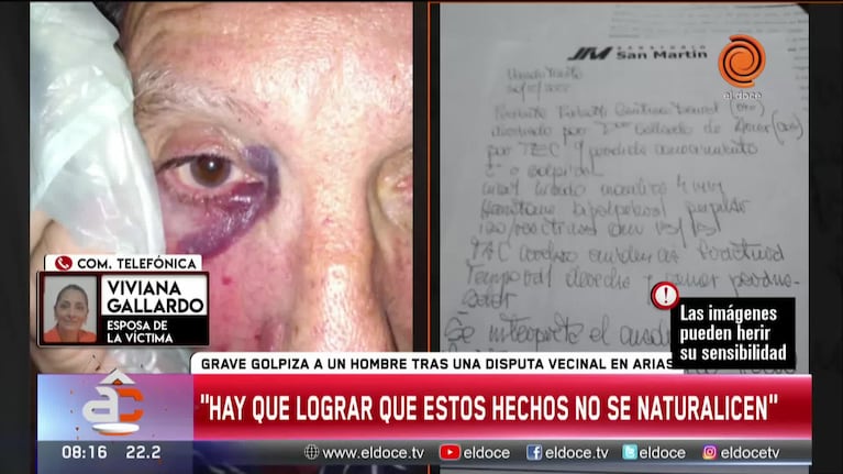 Asegura que su marido discutió con vecinos y le dieron una brutal golpiza