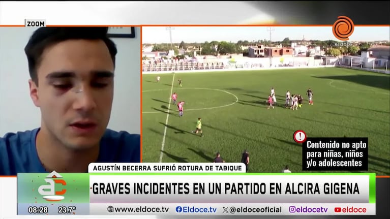Incidentes en un partido en Alcira Gigena: le quebraron el tabique a un jugador